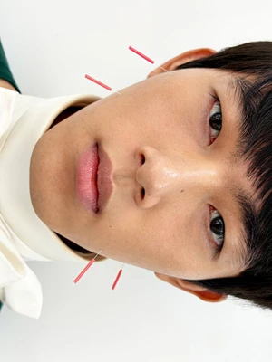 Close-up portrait of a man with acupuncture needles in his face against a white seamless background for GQ China.