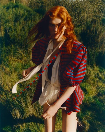 Portrait of a red-haired woman in a striped top outdoors. She is standing in a grassy field with trees in the background.