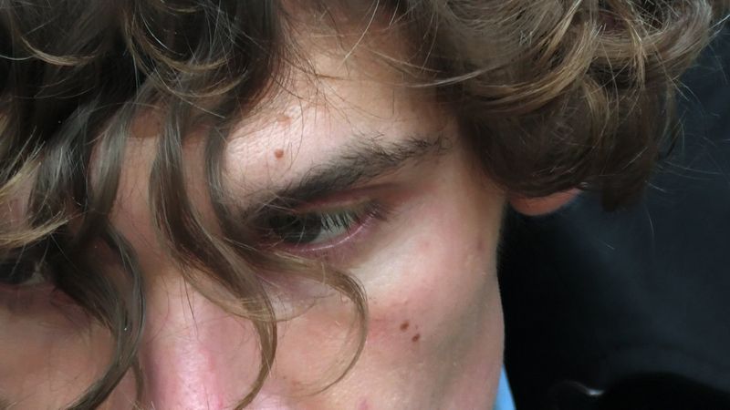 Close-up portrait of a young man with curly brown hair and moles on his face for The Correct Distance Magazine editorial.
