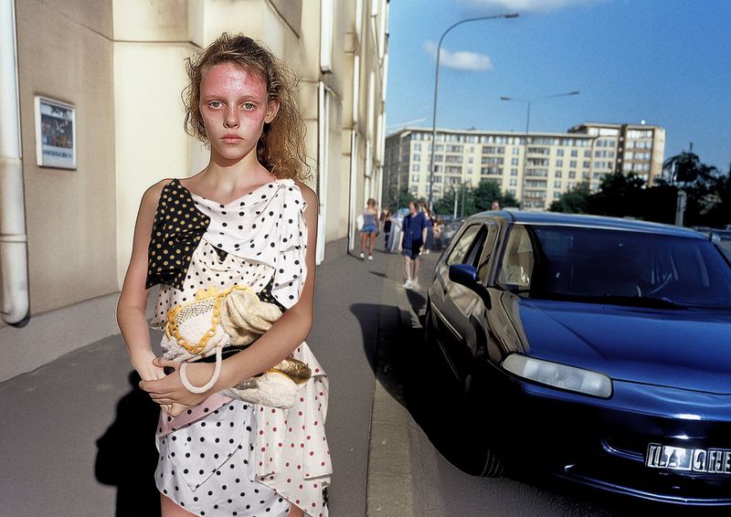 Young woman with sunburned skin poses outdoors wearing a polka-dot dress, holding a bag, standing next to a dark blue car on a city street.