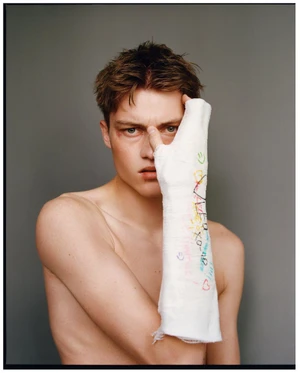 Shirtless young man posing against a neutral grey studio background holding up a white arm cast covered in colorful marker drawings.
