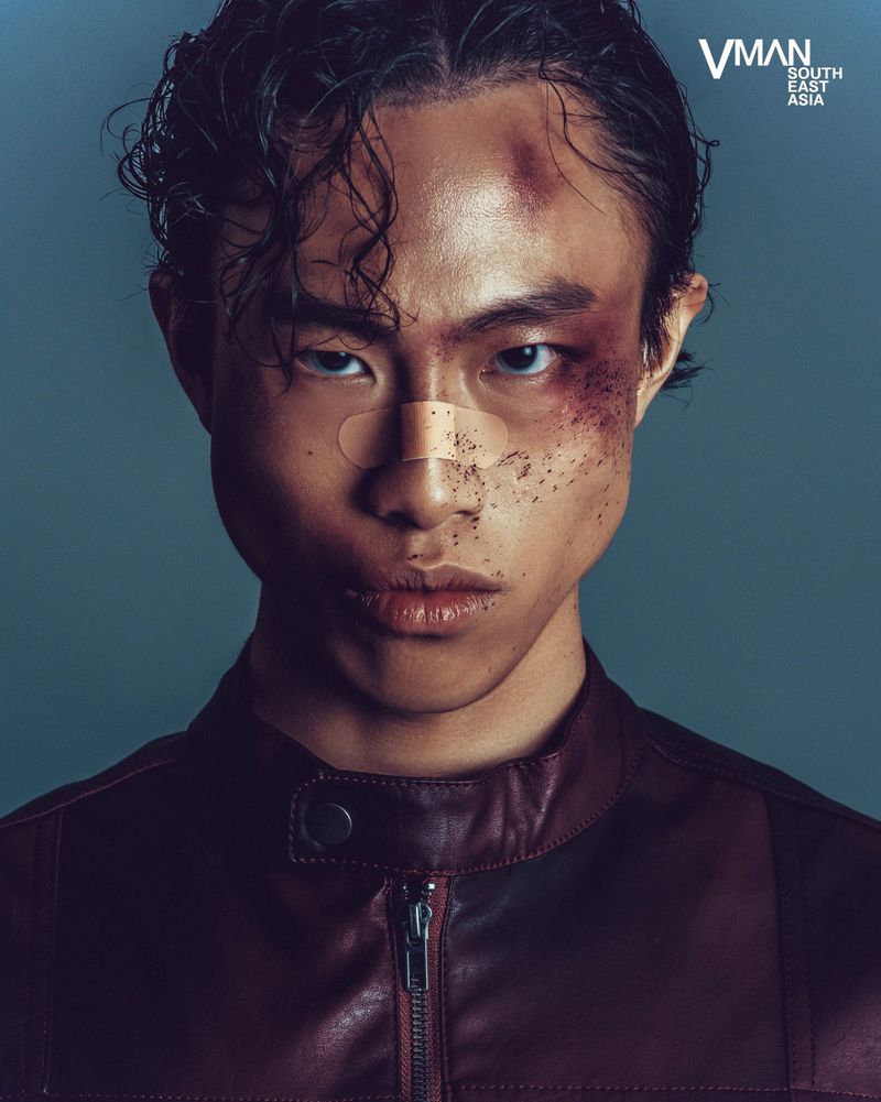 Portrait of a young adult with band-aids on his nose and a bruise on his face, wearing a leather jacket, looking at the camera.