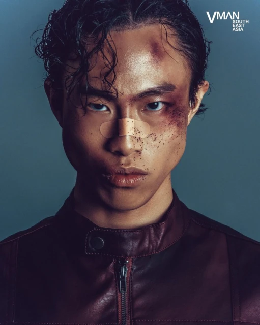 Portrait of a young adult with band-aids on his nose and a bruise on his face, wearing a leather jacket, looking at the camera.