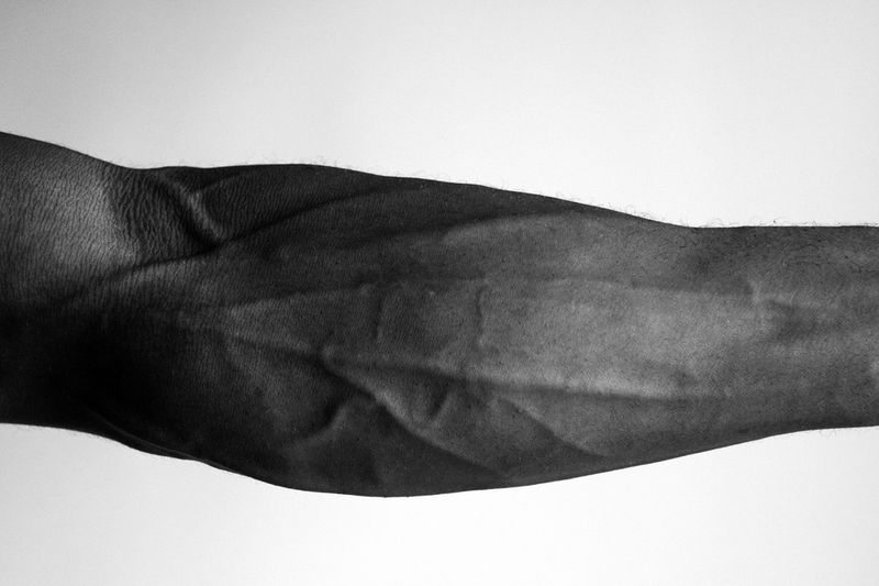 Close-up monochrome image of an adult's forearm with visible veins and skin texture, set against a plain white background.