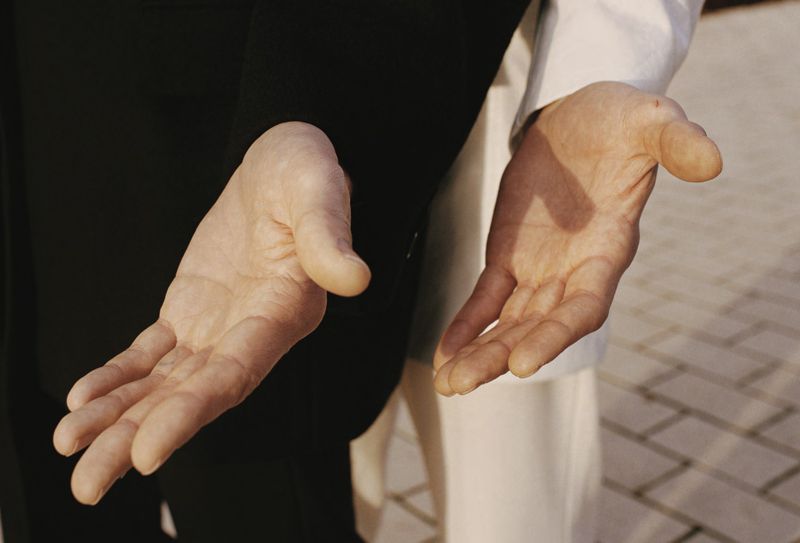 Close-up of two adult human hands, palms up, with black and white clothing in the background, showing skin texture in outdoor lighting.