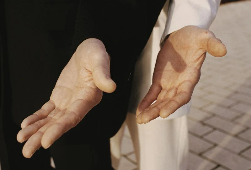 Close-up of two adult human hands, palms up, with black and white clothing in the background, showing skin texture in outdoor lighting.