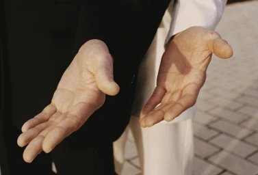 Close-up of two open palms held out towards the camera against an outdoor paved ground.
