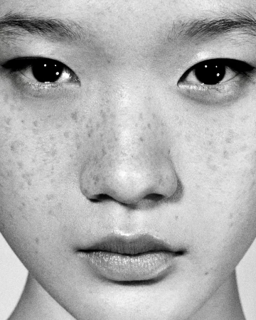 Close-up monochrome portrait of a young East Asian person with detailed freckles across the nose and cheeks.