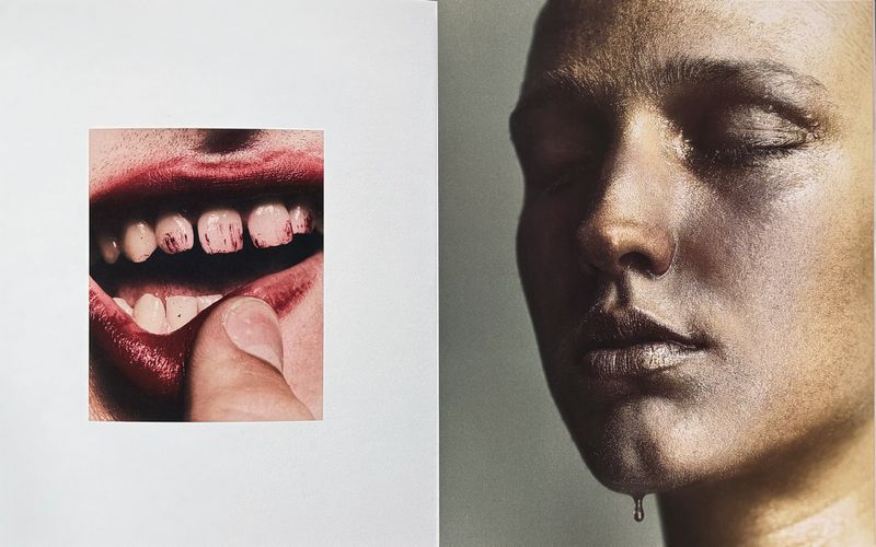 Close-up split layout showing teeth with red marks on the left and a portrait of a person with a droplet on the chin on the right.