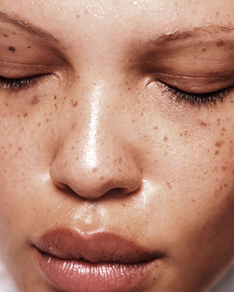 Close-up of a young adult woman with freckles, closed eyes, and glossy lips, emphasizing skincare and natural beauty in soft lighting.