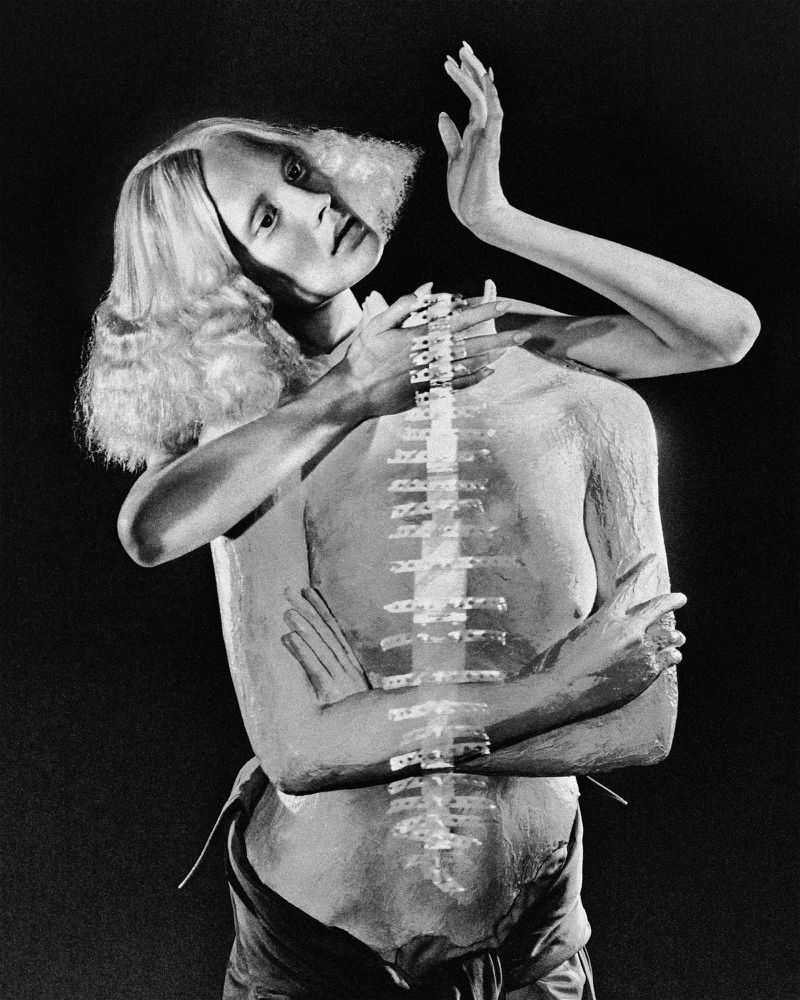 Artistic black and white photograph of an adult woman's face, a sculpture of a human torso, and an internal spine model in close-up.