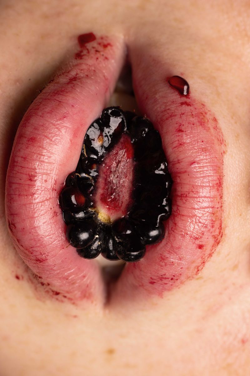 Close-up of a stoma, a surgically created opening in the abdomen, with dark fluid and reddish tissue visible around the edges.